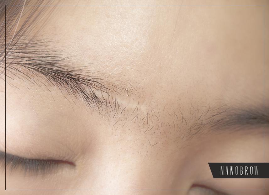 comment masquer la cicatrice dans les sourcils
